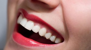 Smile_Lip_bg_171217875